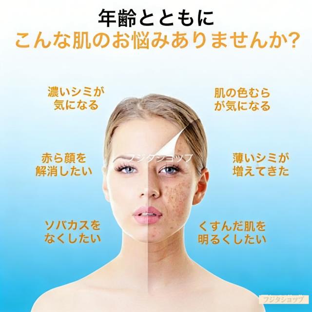ピコレーザー 美顔器 美容機器 自宅 家庭用 レーザーペン シミ取り
